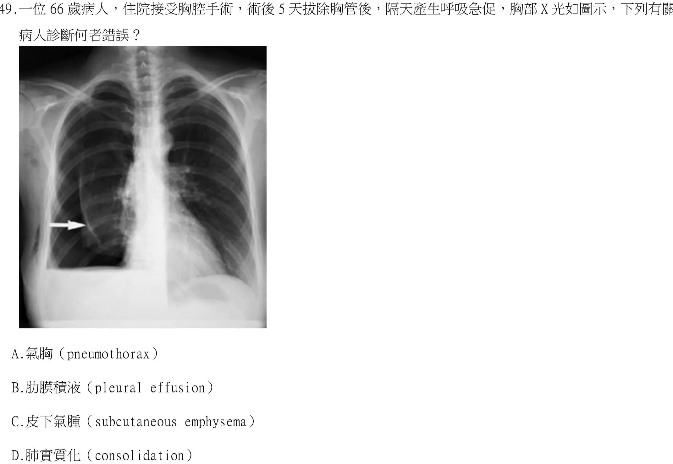 question 圖片