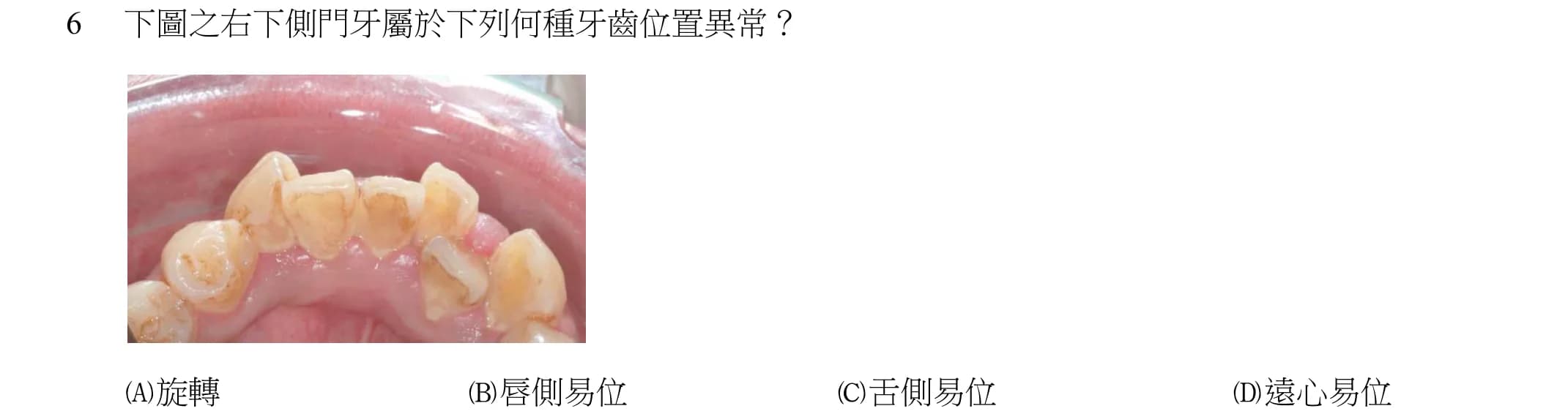 question 圖片