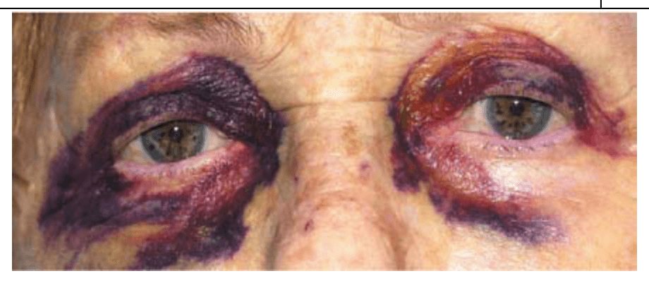 question 圖片