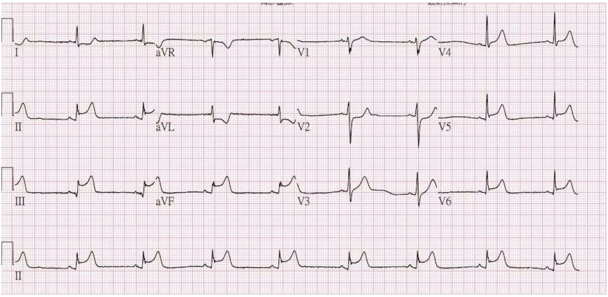 question 圖片
