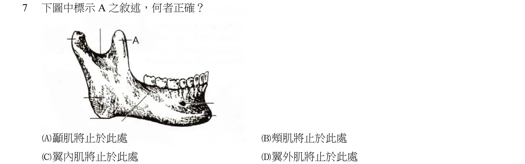 question 圖片