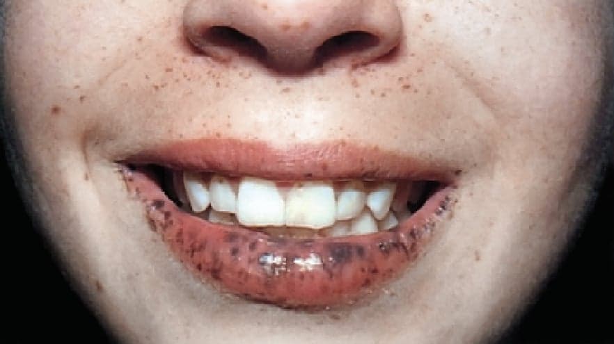 question 圖片