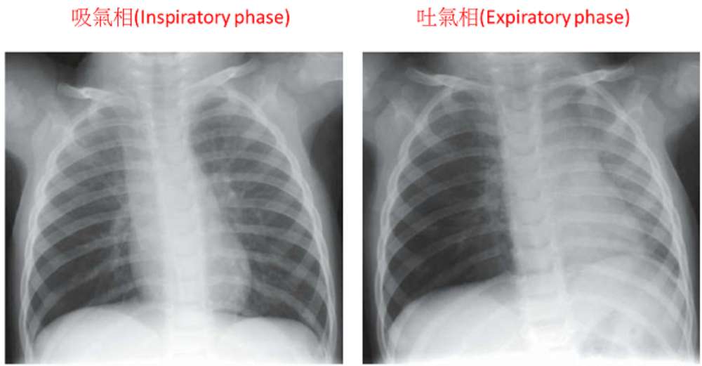 題目附圖